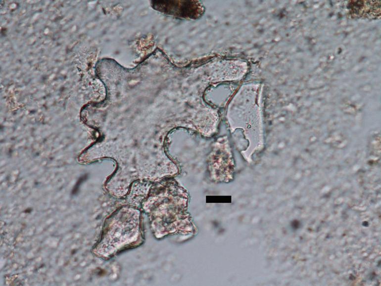 صورة مجهرية لحفرية phytoliths النباتية - صور مجهرية