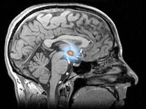 article_codev-2013-07-03-16fe2e4f01-hypothalamus