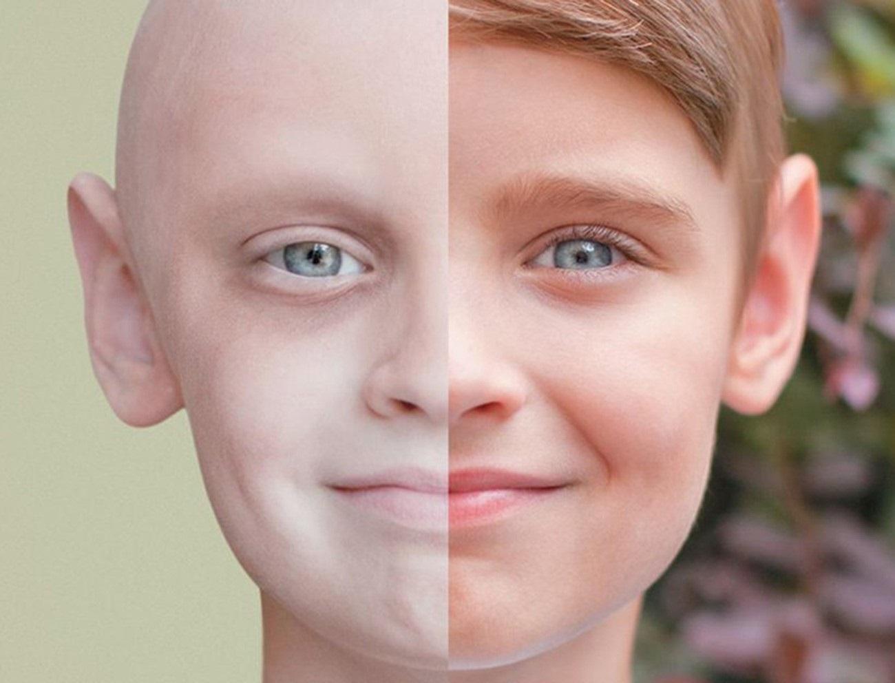 حرب الإنسان ومرض السرطان