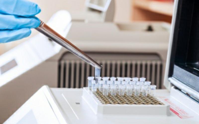 الـ PCR - معمل بيولوجيا