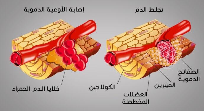 مكونات الدم التي تساعد على التخثر