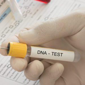 كيفية إجراء فحص DNA