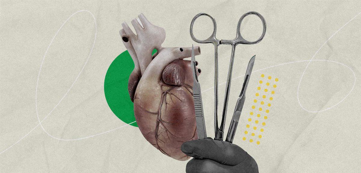 أدوات جراحة القلب