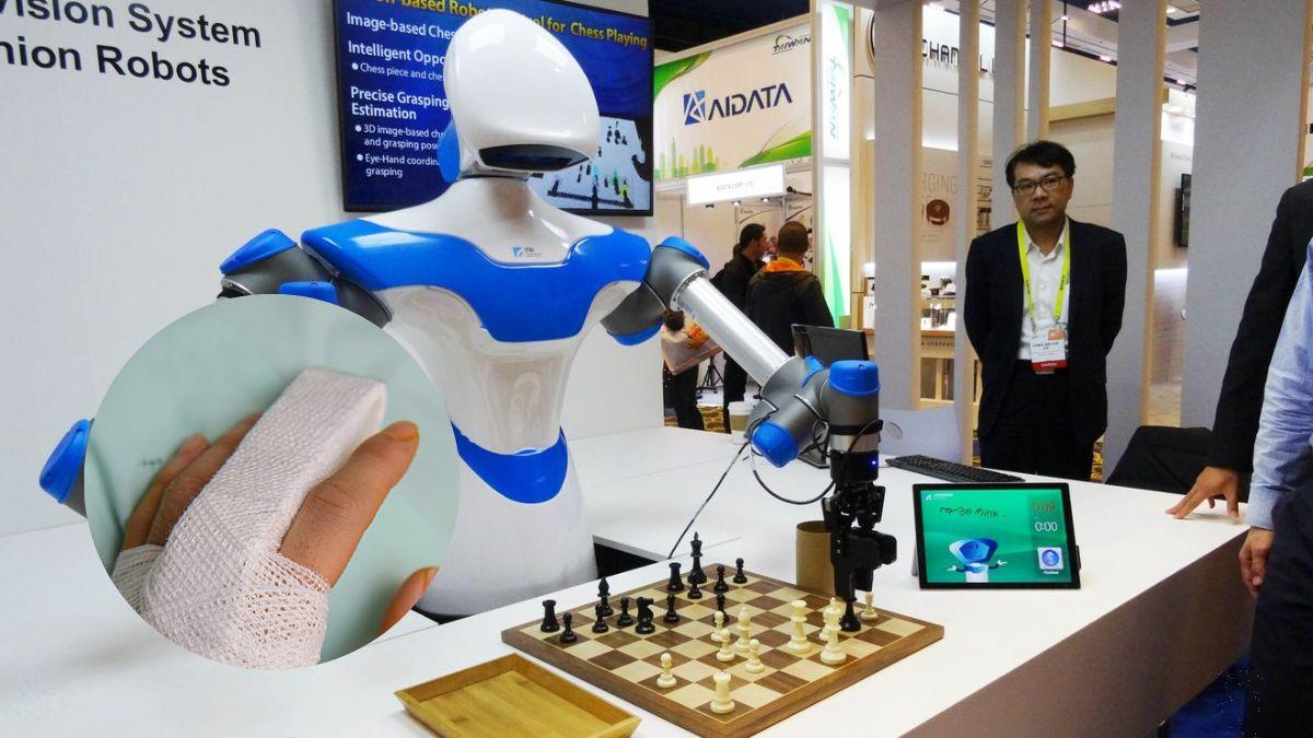 روبوت يكسر إصبع طفل عمره 7 سنوات خلال بطولة للشطرنج لأنّه أخلّ بقواعد اللعبة