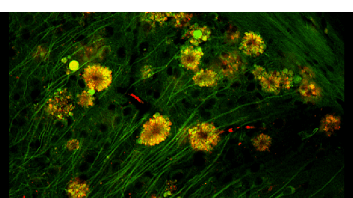 الزهور السامّة العصبية وطريقة جديدة لعلاج مرض ألزهايمر!