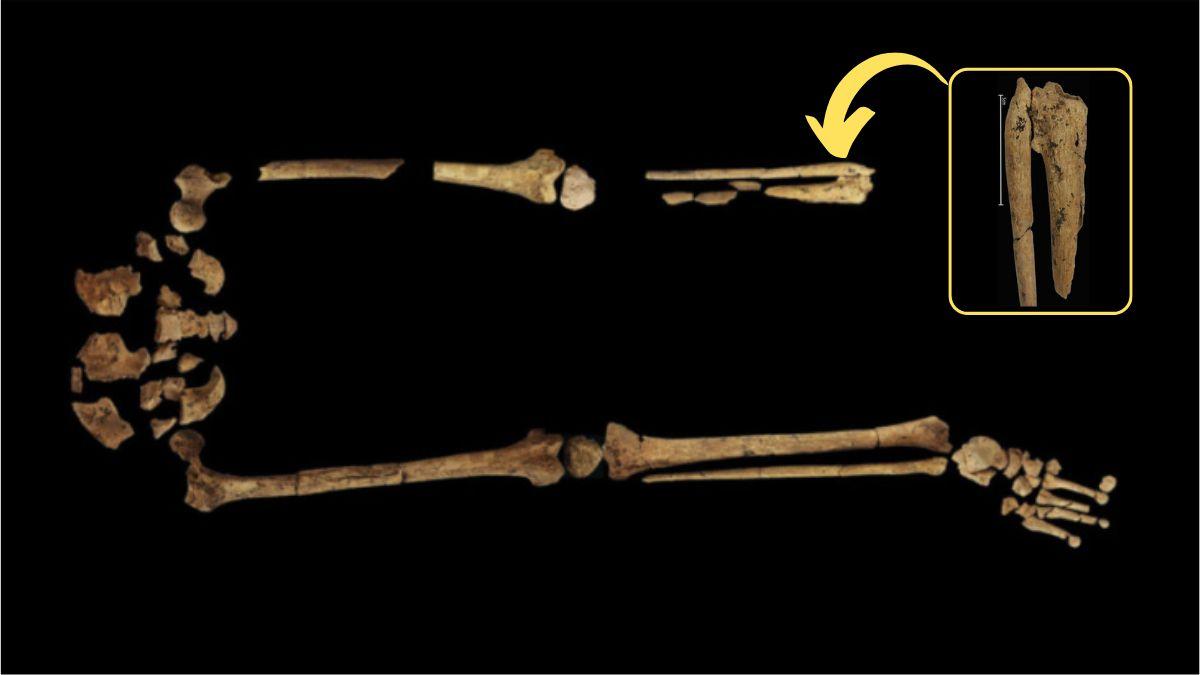 العثور على دليل لأقدم عملية جراحية في العالم حصلت من 31000 عام في بورنيو!