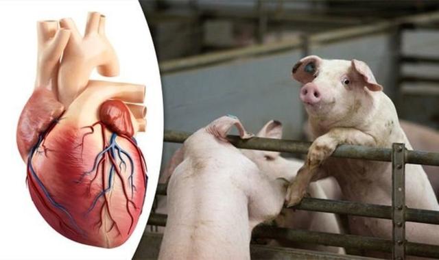 نجاح عملية زراعة قلب خنزير في جسم إنسان