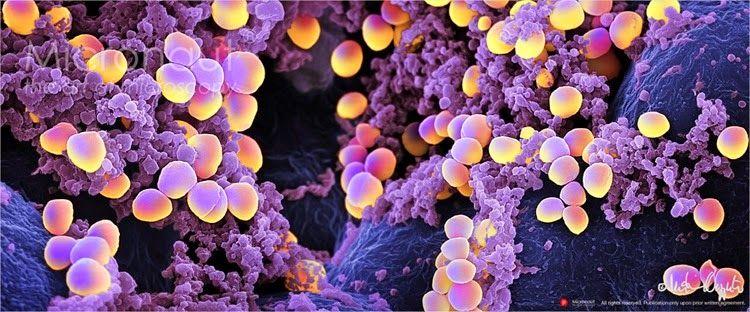Staphylococcus aureus[4]