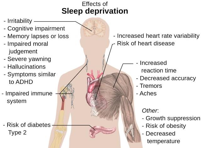 1480px-Effects_of_sleep_deprivation.svg
