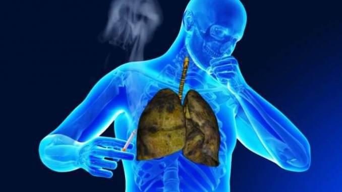 اختصاص الصدر والجهاز التنفسي - الطب البشري