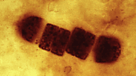 Cyanobacteria - البكتيريا الزرقاء - صور مجهرية