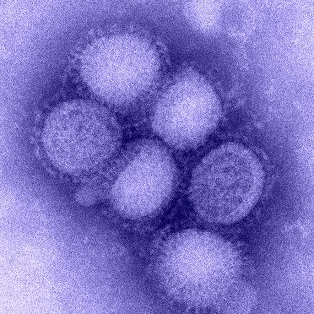 فيروس H1N1 مكبر بالمجهر الإلكتروني الإنفلونزا الإسبانية