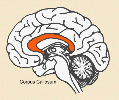 الجسم الثفني (Corpus Callosum) في الدماغ