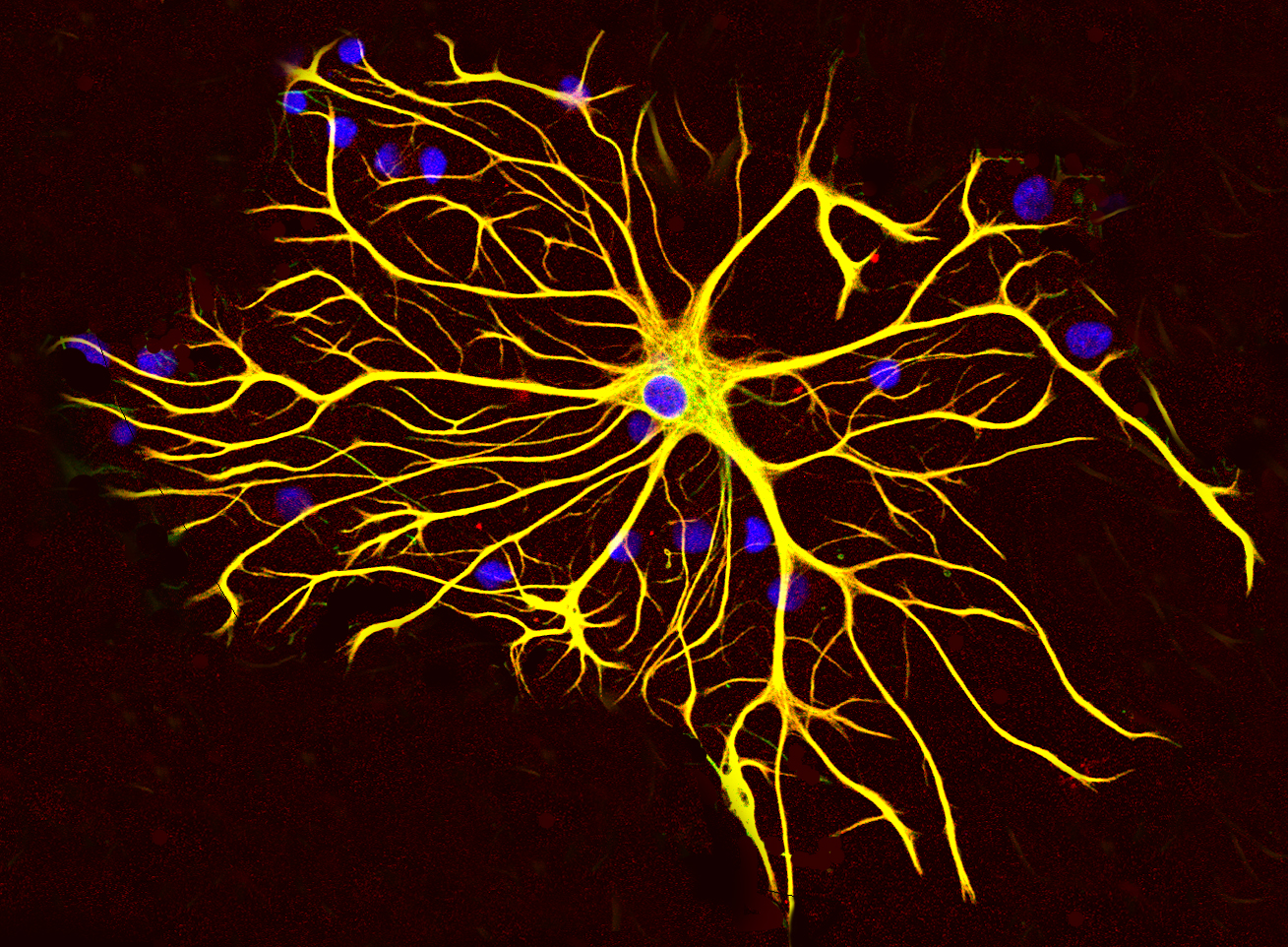 من وظائف الدبق العصبي ربط الخلايا العصبية