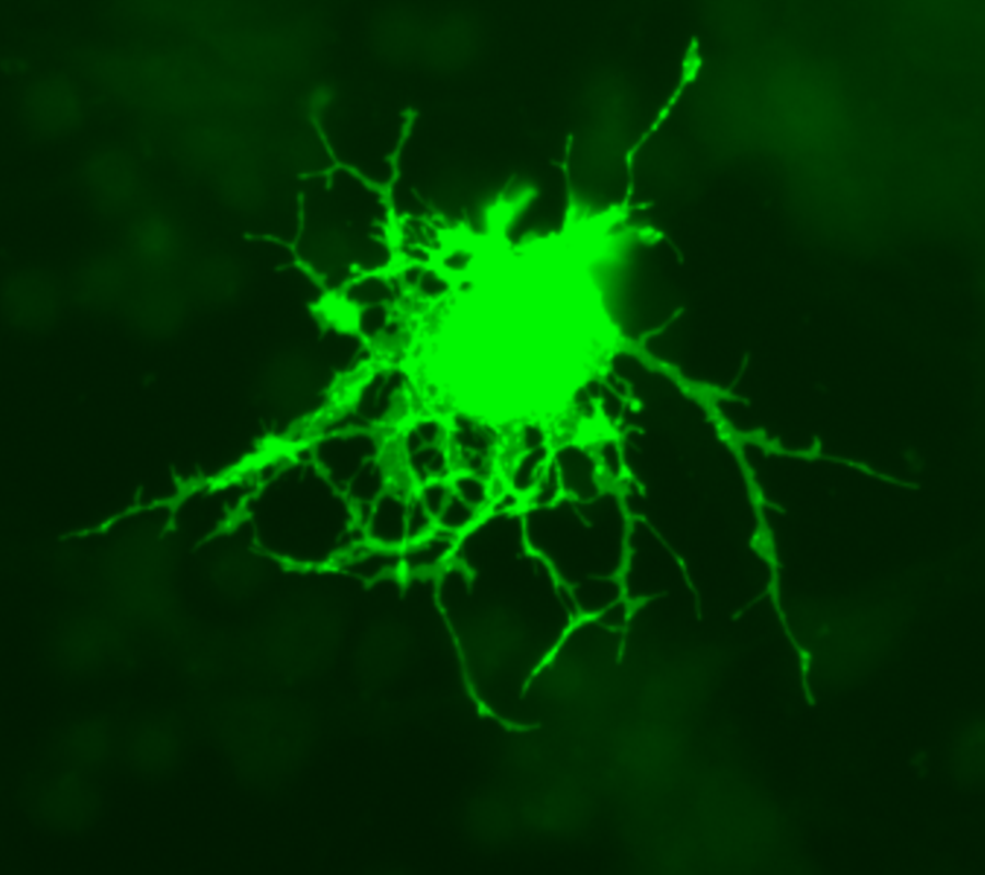 من وظائف الدبق العصبي مساعدة الخلايا العصبية على التواصل